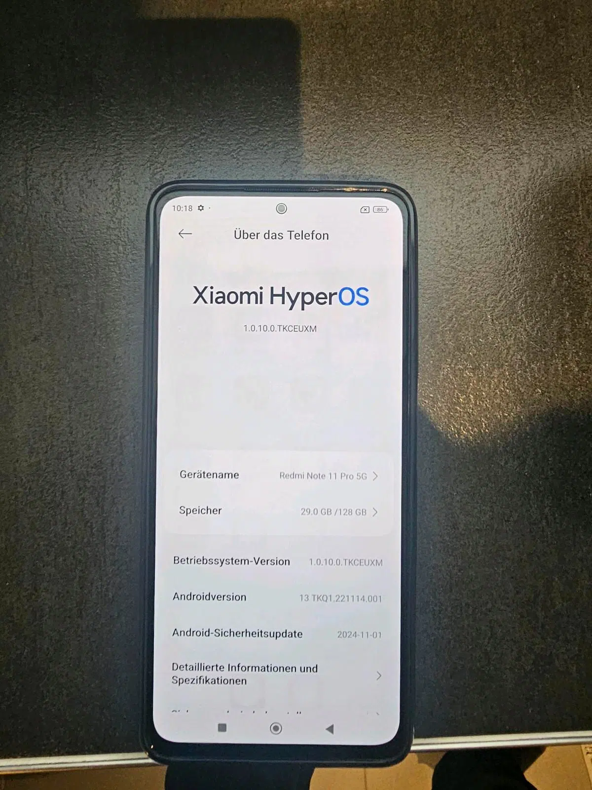 redmi Note 11 pro 5g